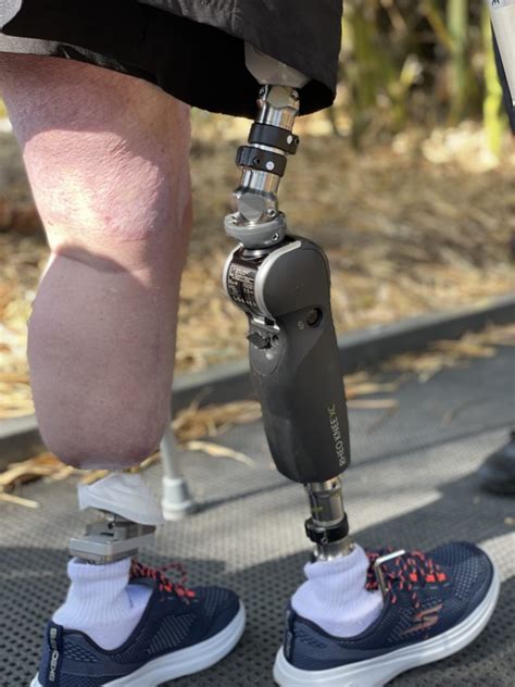 fake legs are call